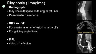 Diagnosis ( Imagimg)
• Radiograph :
• May show Jt space widening or effusion
• Periarticular osteopenia
• Ultrasound:
• For confirmation of effusion in large Jt’s
• For guiding aspirations
• MRI:
• detects jt effusion
 