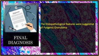 FINAL
DIAGNOSIS
The Histopathological features were suggestive
of Pyogenic Granuloma
 