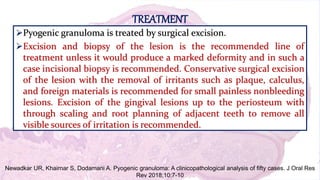 TREATMENT
Pyogenic granuloma is treated by surgical excision.
Excision and biopsy of the lesion is the recommended line of
treatment unless it would produce a marked deformity and in such a
case incisional biopsy is recommended. Conservative surgical excision
of the lesion with the removal of irritants such as plaque, calculus,
and foreign materials is recommended for small painless nonbleeding
lesions. Excision of the gingival lesions up to the periosteum with
through scaling and root planning of adjacent teeth to remove all
visible sources of irritation is recommended.
Newadkar UR, Khairnar S, Dodamani A. Pyogenic granuloma: A clinicopathological analysis of fifty cases. J Oral Res
Rev 2018;10:7-10
 