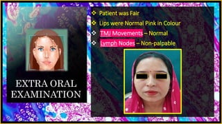 EXTRA ORAL
EXAMINATION
 Patient was Fair
 Lips were Normal Pink in Colour
 TMJ Movements – Normal
 Lymph Nodes – Non-palpable
 