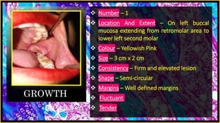 GROWTH
 Number – 1
 Location And Extent – On left buccal
mucosa extending from retromolar area to
lower left second molar
 Colour – Yellowish Pink
 Size – 3 cm x 2 cm
 Consistency – Firm and elevated lesion
 Shape – Semi-circular
 Margins – Well defined margins
 Fluctuant
 Tender
 