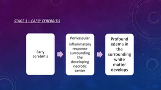 STAGE 1 – EARLY CEREBRITIS
Early
cerebritis
Perivascular
inflammatory
response
surrounding
the
developing
necrotic
center
Profound
edema in
the
surrounding
white
matter
develops
 