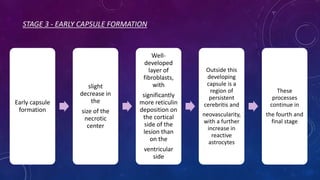 STAGE 3 - EARLY CAPSULE FORMATION
Early capsule
formation
slight
decrease in
the
size of the
necrotic
center
Well-
developed
layer of
fibroblasts,
with
significantly
more reticulin
deposition on
the cortical
side of the
lesion than
on the
ventricular
side
Outside this
developing
capsule is a
region of
persistent
cerebritis and
neovascularity,
with a further
increase in
reactive
astrocytes
These
processes
continue in
the fourth and
final stage
 