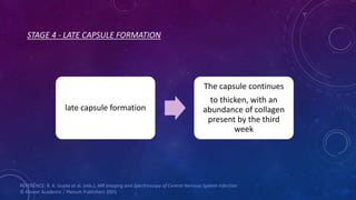 STAGE 4 - LATE CAPSULE FORMATION
late capsule formation
The capsule continues
to thicken, with an
abundance of collagen
present by the third
week
REFERENCE: R. K. Gupta et al. (eds.), MR Imaging and Spectroscopy of Central Nervous System Infection
© Kluwer Academic / Plenum Publishers 2001
 