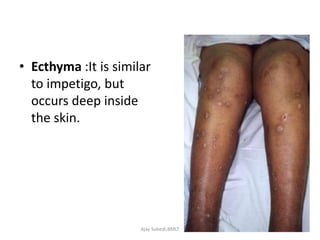 pyogenic infection.pptx