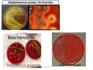 pyogenic infection.pptx