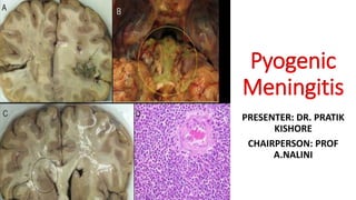 Pyogenic
Meningitis
PRESENTER: DR. PRATIK
KISHORE
CHAIRPERSON: PROF
A.NALINI
 