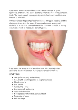 Pyorrhea is a serious gum infection that causes damage to gums,
ligaments, and bone. The pus is discharged from the root of the gums and
teeth. The pus is usually consumed along with food, which could cause a
number of infections.
In the advanced stages of periodontal disease it triggers bleeding and the
discharge of pus from the gums. It is among the most widespread
diseases. It is the most common reason for tooth loss in adults. It usually
occurs as a result of inadequate dental hygiene.
Pyorrhea is the result of a bacterial infection. It is called Pyorrhea
alveolaris. It is most common in people who are older than 40.
SYMPTOMS
● The gums are puffy and swelling.
● Red, bright, sparkling gums, or purplish surfaces
● Bleeding gums
● Bad breath
● Pain during eating
● Gums are soft and supple
● Teeth that are loose
● New spaces will form between your teeth
● Recession of gums
● Pus discharge
 