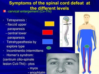Symptoms of the spinal cord defeat atSymptoms of the spinal cord defeat at
the different levelsthe different levels
-- cervical enlargementcervical enlargement (С(Сvv--Thi)Thi)
- TetraparesisTetraparesis ::
-- flaccid upperflaccid upper
paraparesisparaparesis
-- centralcentral lowerlower
paraparesisparaparesis
- Tetrahypesthesia byTetrahypesthesia by
exploreexplore typetype
- ІІncontinentio intermittensncontinentio intermittens
- Horner’s syndromHorner’s syndrom::
((centrum cilio-spinalecentrum cilio-spinale
lesion Cvii-Thii)lesion Cvii-Thii) -- ptosptos
-- myosmyos
-- enophtalmenophtalm
 