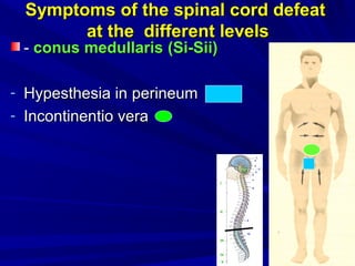 Symptoms of the spinal cord defeatSymptoms of the spinal cord defeat
at the different levelsat the different levels
-- conus medullarisconus medullaris ((Si-Sii)Si-Sii)
- Hypesthesia inHypesthesia in perineumperineum
- ІІncontinentio verancontinentio vera
 
