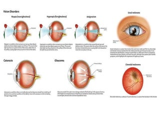 Pyrexia, ophthalmic symptoms and Worm Infestations | PPTX