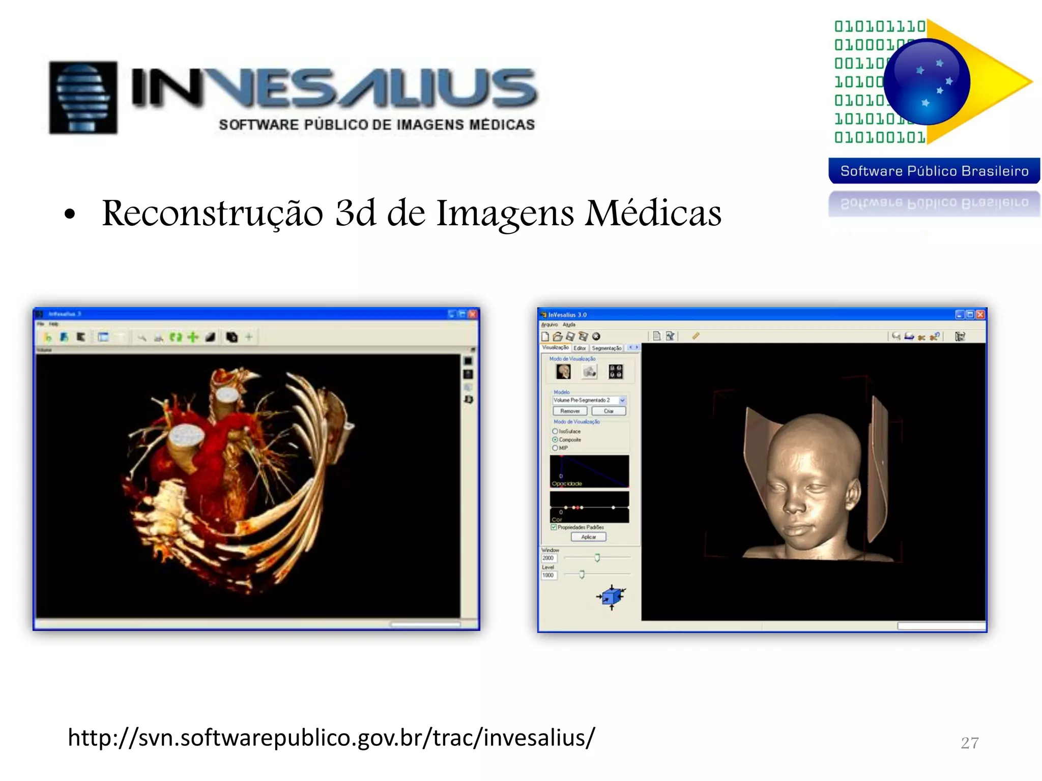 • Reconstrução 3d de Imagens Médicas http://svn.softwarepublico.gov.br/trac/invesalius/ 27 