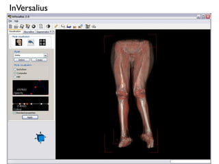 InVersalius
 