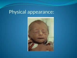 Physical appearance:
 