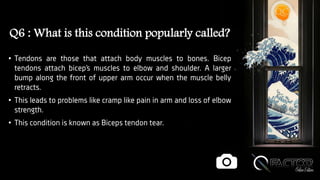 Q6 : What is this condition popularly called?
• Tendons are those that attach body muscles to bones. Bicep
tendons attach bicep’s muscles to elbow and shoulder. A larger
bump along the front of upper arm occur when the muscle belly
retracts.
• This leads to problems like cramp like pain in arm and loss of elbow
strength.
• This condition is known as Biceps tendon tear.
 