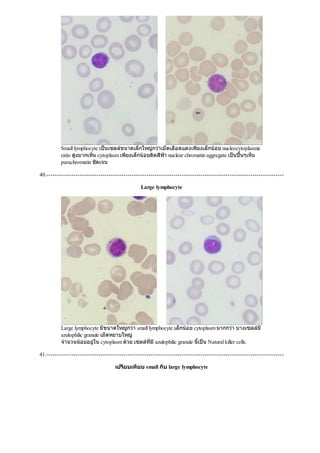 Small lymphocyte เปนเซลลขนาดเล็กใหญกวาเม็ดเลือดแดงเพียงเล็กนอย nucleocytoplasmic
ratio สูงมากเห็น cytoplasm เพียงเล็กนอยติดสีฟา nuclear chromatin aggregate เปนปนๆเห็น
parachromatin ชัดเจน
40.------------------------------------------------------------------------------------------------------------------
Large lymphocyte
Large lymphocyte มีขนาดใหญกวา small lymphocyte เล็กนอย cytoplasm มากกวา บางเซลลมี
azulophilic granule เม็ดหยาบใหญ
จํานวนนอยอยูใน cytoplasm ดวย เซลลที่มีazulophilic granule นี้เปน Natural killer cells.
41.------------------------------------------------------------------------------------------------------------------
เปรียบเทียบ small กับ large lymphocyte
 