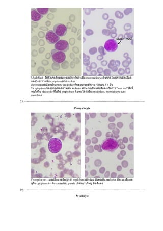 Myeloblast : ใหสังเกตลักษณะเซลลจะเห็นวาเปน mononuclear cell ขนาดใหญกวาเม็ดเลือด
แดง3-4 เทา เห็น cytoplasm มาก nuclear
chromatin ละเอียดปานกลาง nucleolus เห็นขอบเขตชัดเจน จํานวน 3-5 อัน
ใน cytoplasm ของบางเซลลอาจเห็น inclusion ลักษณะเปนแทงสีแดง เรียกวา “auer rod” สิ่งนี้
พบไดใน blast cells ที่ไมใชlymphoblast คือพบไดทั้งใน myeloblast , promyelocyte และ
monoblast
55.------------------------------------------------------------------------------------------------------------------
Promyelocyte
Promyelocyte : เซลลมีขนาดใหญกวา myeloblast เล็กนอย ยังคงเห็น nucleolus ชัดเจน สังเกต
ดูใน cytoplasm จะเห็น azulophilic granule เม็ดหยาบใหญติดสีแดง
56.------------------------------------------------------------------------------------------------------------------
Myelocyte
 
