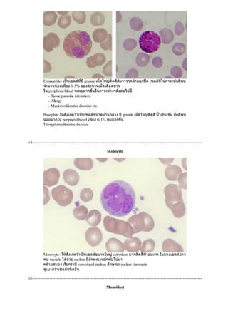Eosinophils : เปนเซลลที่มีgranule เม็ดใหญติดสีสมวาวๆคลายลูกปด เซลลนี้ในภาวะปกติพบ
จํานวนนอยเพียง 1-5% ของจํานวนเม็ดเลือดขาว
ใน peripheral blood จะพบมากขึ้นในภาวะตางๆดังตอไปนี้
- Tissue parasitic infestation
- Allergy
- Myeloproliferative disorder etc.
Basophils: ใหสังเกตวาเปนเซลลขนาดปานกลาง มีgranule เม็ดใหญติดสีนํ้าเงินเขม ปกติพบ
นอยมากใน peripheral blood เพียง 0-1% พบมากขึ้น
ใน myeloproliferative disorder
64.------------------------------------------------------------------------------------------------------------------
Monocyte
Monocyte : ใหสังเกตวาเปนเซลลขนาดใหญcytoplasm มากติดสีฟาอมเทา ในบางเซลลอาจ
พบ vacuole ไดดวย nucleus มีลักษณะหยักพับไปมา
คลายสมอง เรียกวามีconvoluted nucleus ลักษณะ nuclear chromatin
ฟูเบากวาเซลลชนิดอื่น
65.------------------------------------------------------------------------------------------------------------------
Monoblast
 