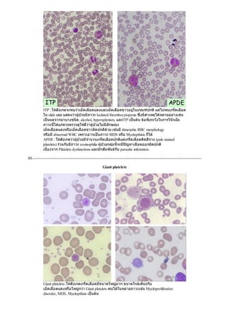 ITP : ใหสังเกตจะพบวาเม็ดเลือดแดงและเม็ดเลือดขาวอยูในเกณฑปกติแตไมพบเกร็ดเลือด
ใน slide เลย แสดงวาผูปวยมีภาวะ Isolated thrombocytopenia ซึ่งมีสาเหตุไดหลายอยางเชน
เปนผลจากยาบางชนิด, alcohol, hypersplenism, และITP เปนตน ขอพึงระวังในการวินิจฉัย
ภาวะนี้ไดแกควรตรวจดูใหดีวาผูปวยไมมีลักษณะ
เม็ดเลือดแดงหรือเม็ดเลือดขาวผิดปกติดวย เชนมีdimorphic RBC morphology
หรือมีabnormal WBC เพราะอาจเปนภาวะ MDS หรือ Myelopthisis ก็ได
APDE : ใหสังเกตวาผูปวยมีจํานวนเกร็ดเลือดปกติแตเกร็ดเลือดติดสีจาง (pale stained
platelets) รวมกับมีภาวะ eosinophilia ผูปวยกลุมนี้จะมีปญหาเลือดออกผิดปกติ
เนื่องจาก Platelets dysfunctions และมักสัมพันธกับ parasitic infestation.
80.------------------------------------------------------------------------------------------------------------------
Giant platelets
Giant platelets: ใหสังเกตเกร็ดเลือดมีขนาดใหญมาก ขนาดใกลเคียงกับ
เม็ดเลือดแดงหรือใหญกวา Giant platelets พบไดในหลายภาวะเชน Myeloproliferative
disorder, MDS, Myelopthisis เปนตน
 