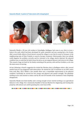 Page | 33
Satyendra Manjhi- A patient of Tuberculosis with enlarged gland
Swollen Gland at start of Treatment (May,2013) Swelling reduced during DOT treatment (Oct, 2013) Swelling cured after DOT treatment(Jan, 2014)
Satyendra Manjhi, a 30 year old resident of Arjunbigha, Bodhgaya, had come to our clinic to treat a
lump in his neck, which had been developed for quite sometime and was causing him a lot of pain.
After several futile efforts of local doctors around his village to cure him he went to Varanasi, in the
neighbouring state of Uttar Pradesh, in search of proper treatment. Unfortunately, there too nobody
could diagnose his problem correctly and he returned to his village utterly dejected. His physical
condition was so weak that he had to leave his job as an out-migrant labourer and return to his village.
This caused a huge set-back for his family consisting of his parents, wife and four brothers, as he was
the main source of earning.
At last, following a friend’s suggestion he visited the Shechen clinic in Bodhgaya where, after several
medical tests he was diagnosed with tuberculosis. He started his CAT II treatment at our DOT centre
from early May, 2013. Within a few months there was a remarkable improvement in his physical
condition. Eventually he revived his lost energy and physical and mental strength. The glandular
swelling on his neck started to reduce and by the end of 8 months of his treatment it had completely
disappeared.
Satyendra Manjhi now feels healthy and is strong enough to have started working as an agricultural
labourer in his village. He is immensely thankful to Karuna-Shechen for diagnosing and treating him
properly, with utmost care and for granting him a new lease of life.
 