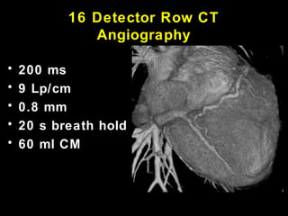 16 Detector Row CT
Angiography
• 200 ms
• 9 Lp/cm
• 0.8 mm
• 20 s breath hold
• 60 ml CM
 