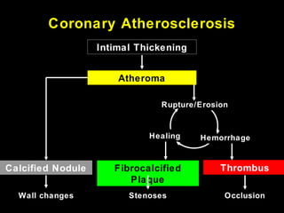 Coronary Atherosclerosis
Calcified Nodule
Wall changes Occlusion
ThrombusFibrocalcified
Plaque
Stenoses
Intimal Thickening
Atheroma
Healing Hemorrhage
Rupture/Erosion
 