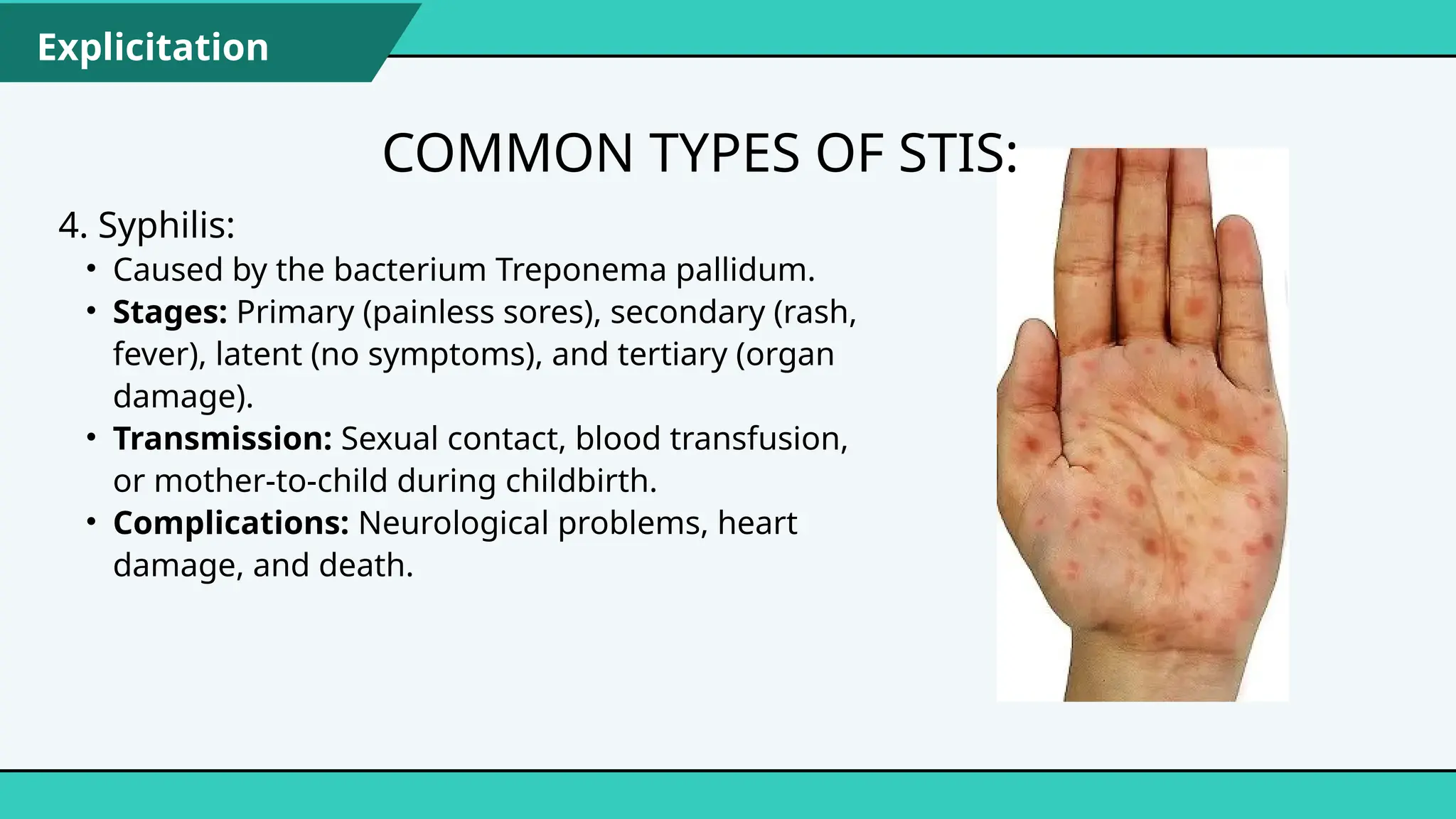 Treponema Rash Quarter 1_PPT_PE & HEALTH 8_WEEK 3-4.pptx