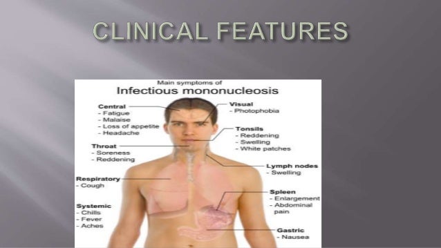 test blood 6 hhv of the viral oral lesions cavity test blood 6 hhv of the viral oral lesions cavity