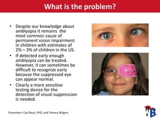 Amblyopia Early Detection Device