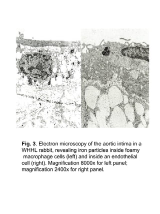 Fig. 3. Electron microscopy of the aortic intima in a
WHHL rabbit, revealing iron particles inside foamy
macrophage cells (left) and inside an endothelial
cell (right). Magnification 8000x for left panel;
magnification 2400x for right panel.
 