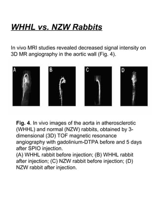 WHHL vs. NZW Rabbits
In vivo MRI studies revealed decreased signal intensity on
3D MR angiography in the aortic wall (Fig. 4).
Fig. 4. In vivo images of the aorta in atherosclerotic
(WHHL) and normal (NZW) rabbits, obtained by 3-
dimensional (3D) TOF magnetic resonance
angiography with gadolinium-DTPA before and 5 days
after SPIO injection.
(A) WHHL rabbit before injection; (B) WHHL rabbit
after injection; (C) NZW rabbit before injection; (D)
NZW rabbit after injection.
 