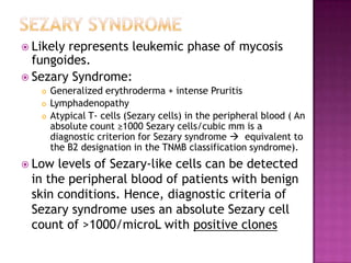  Likely represents leukemic phase of mycosis
fungoides.
 Sezary Syndrome:
 Generalized erythroderma + intense Pruritis
 Lymphadenopathy
 Atypical T- cells (Sezary cells) in the peripheral blood ( An
absolute count ≥1000 Sezary cells/cubic mm is a
diagnostic criterion for Sezary syndrome  equivalent to
the B2 designation in the TNMB classification syndrome).
 Low levels of Sezary-like cells can be detected
in the peripheral blood of patients with benign
skin conditions. Hence, diagnostic criteria of
Sezary syndrome uses an absolute Sezary cell
count of >1000/microL with positive clones
 