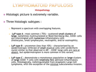 Histopathology
 Histologic picture is extremely variable.
 Three histologic subtypes :
 Represent a spectrum with overlapping features.
 LyP type A : most common ( 75%) - scattered small clusters of
large, sometimes multinucleated or Reed-Sternberg-like, CD30+ cells
are intermingled with numerous inflammatory cells
(histiocytes, small lymphocytes, neutrophils, and/or eosinophils).
 LyP type B : uncommon (less than 10%) - characterized by an
epidermotropic infiltrate of small atypical cells with cerebriform
nuclei similar to that observed in MF. . CD30+ large cells are rare or
absent, but epidermotropism is more common in this variant.
 LyP type C : demonstrate a monotonous population or large clusters
of large CD30+ T cells with relatively few admixed inflammatory
cells. Histologically, indistinguishable from Anaplastic Large Cell
Lymphoma, with the exception of the minimal subcutaneous invasion.
 