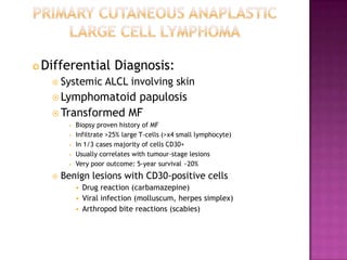  Differential Diagnosis:
 Systemic ALCL involving skin
 Lymphomatoid papulosis
 Transformed MF
• Biopsy proven history of MF
• Infiltrate >25% large T-cells (>x4 small lymphocyte)
• In 1/3 cases majority of cells CD30+
• Usually correlates with tumour-stage lesions
• Very poor outcome: 5-year survival ~20%
 Benign lesions with CD30-positive cells
• Drug reaction (carbamazepine)
• Viral infection (molluscum, herpes simplex)
• Arthropod bite reactions (scabies)
 