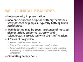  Heterogeneity in presentation.
 Indolent cutaneous eruption with erythematous
scaly patches or plaques, typically bathing trunk
distribution.
 Poikiloderma may be seen - presence of mottled
pigmentation, epidermal atrophy, and
telangiectasia associated with slight infiltration.
 3 Phases of progression:
 Macular erythematous eruption
 Plaque/Patch phase, resembles eczema/psoriasis
 Tumor nodules/ generalized erythroderma and associated
adenopathy or visceral involvement ( Often seen in Sezary
Syndrome)
 Circulating Sezary Cells
 