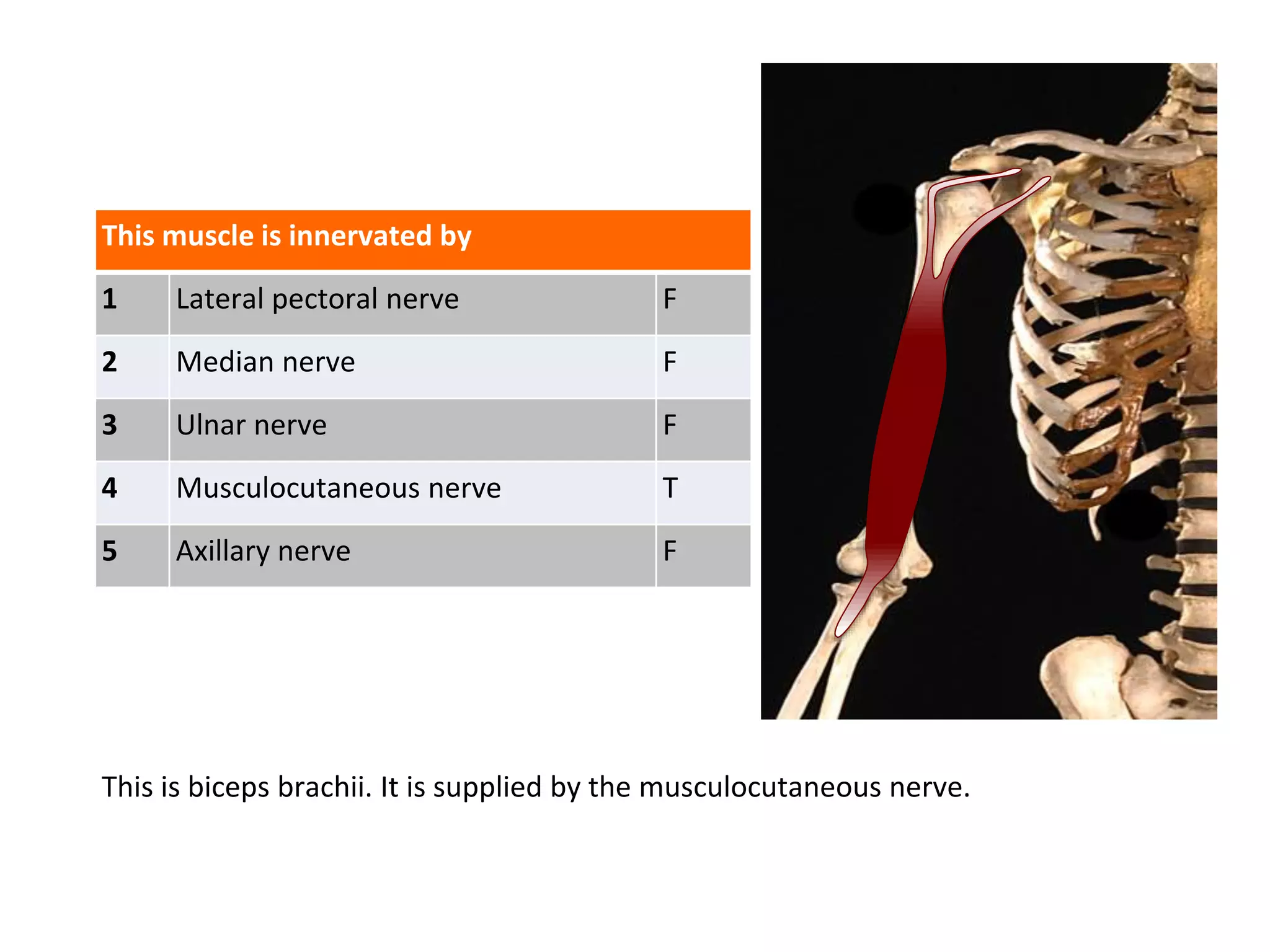 This muscle is innervated by
1 Lateral pectoral nerve F
2 Median nerve F
3 Ulnar nerve F
4 Musculocutaneous nerve T
5 Axillary nerve F
This is biceps brachii. It is supplied by the musculocutaneous nerve.
 