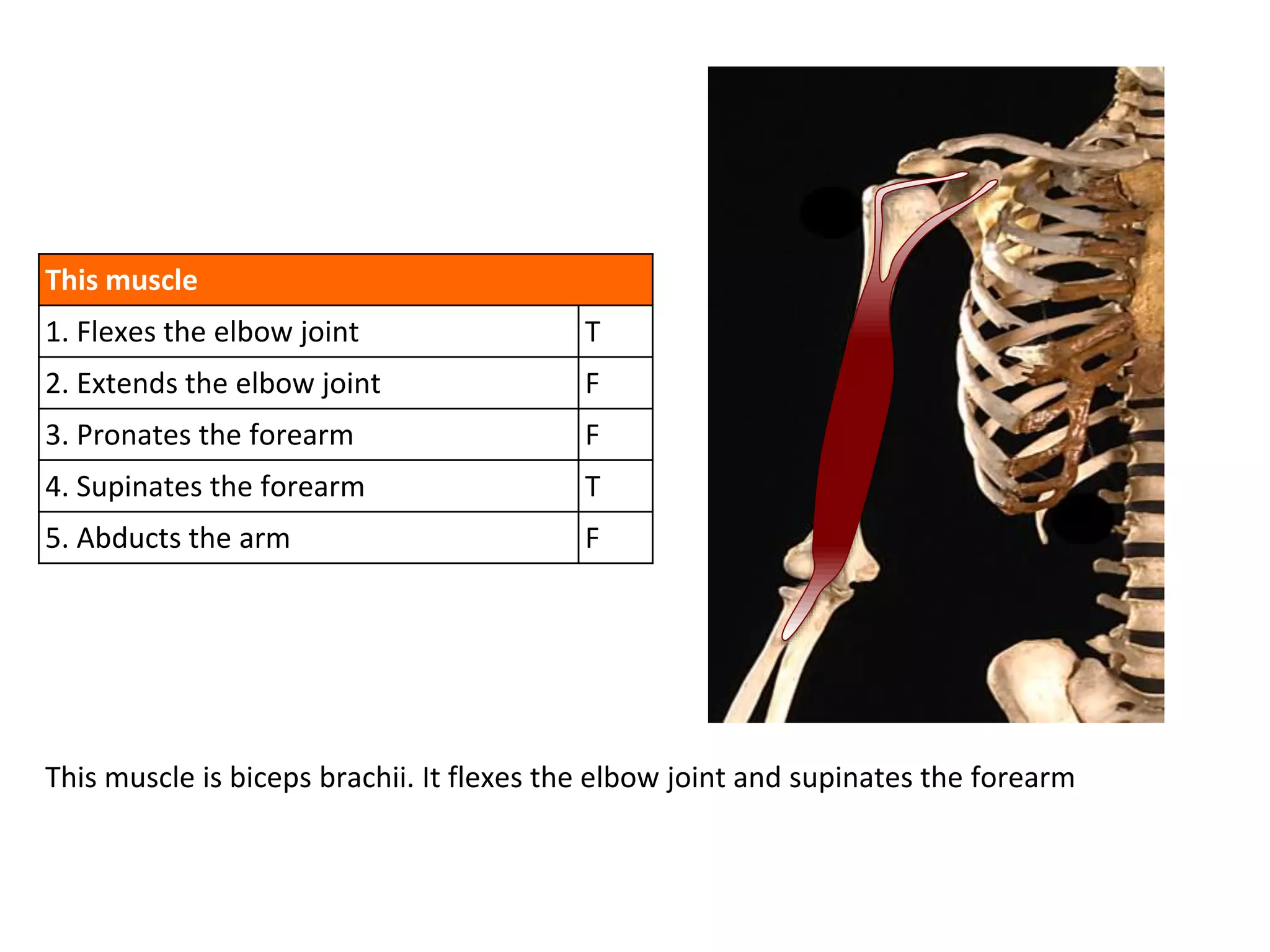 This muscle
1. Flexes the elbow joint T
2. Extends the elbow joint F
3. Pronates the forearm F
4. Supinates the forearm T
5. Abducts the arm F
This muscle is biceps brachii. It flexes the elbow joint and supinates the forearm
 