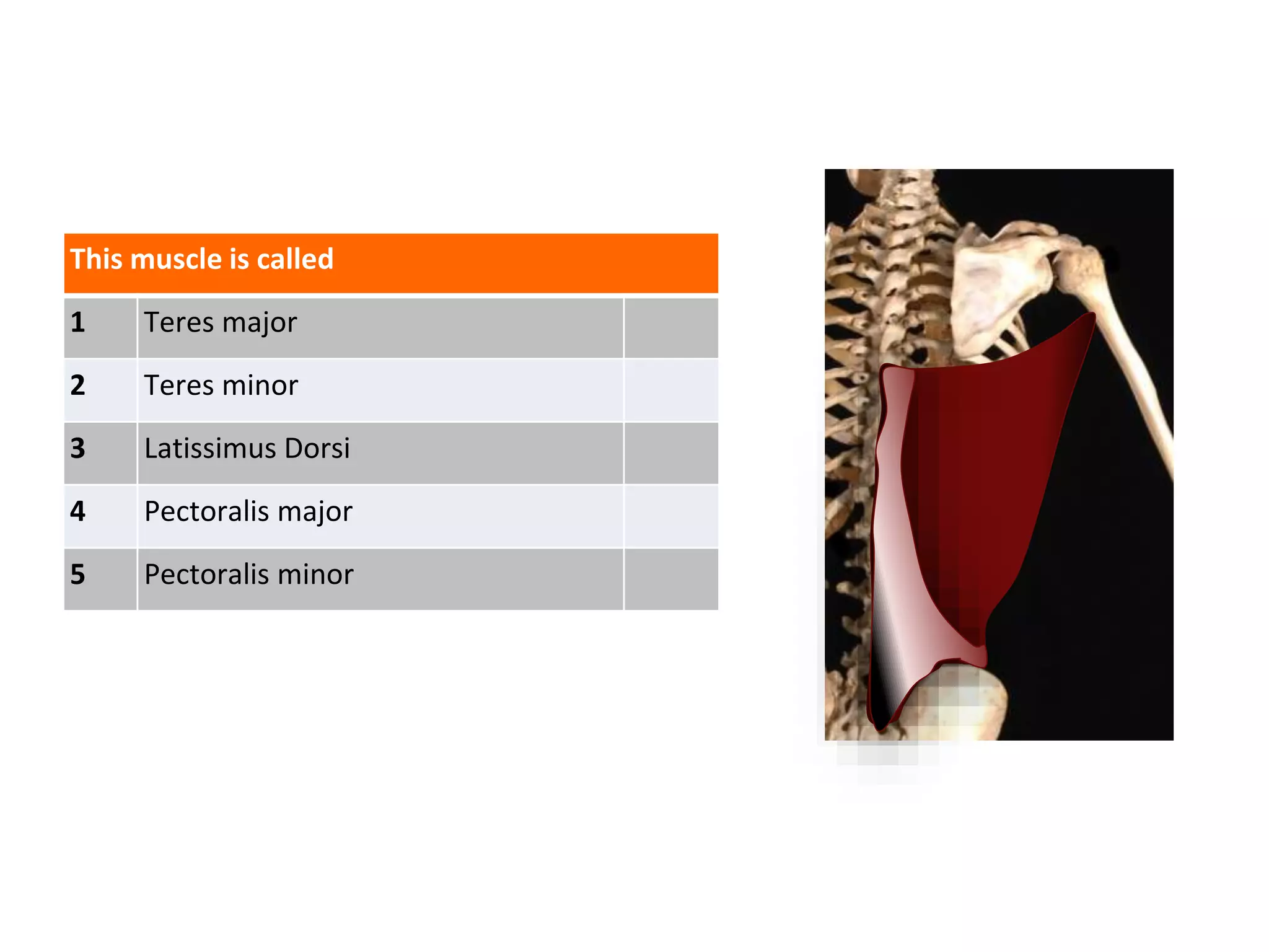 This muscle is called
1 Teres major
2 Teres minor
3 Latissimus Dorsi
4 Pectoralis major
5 Pectoralis minor
 