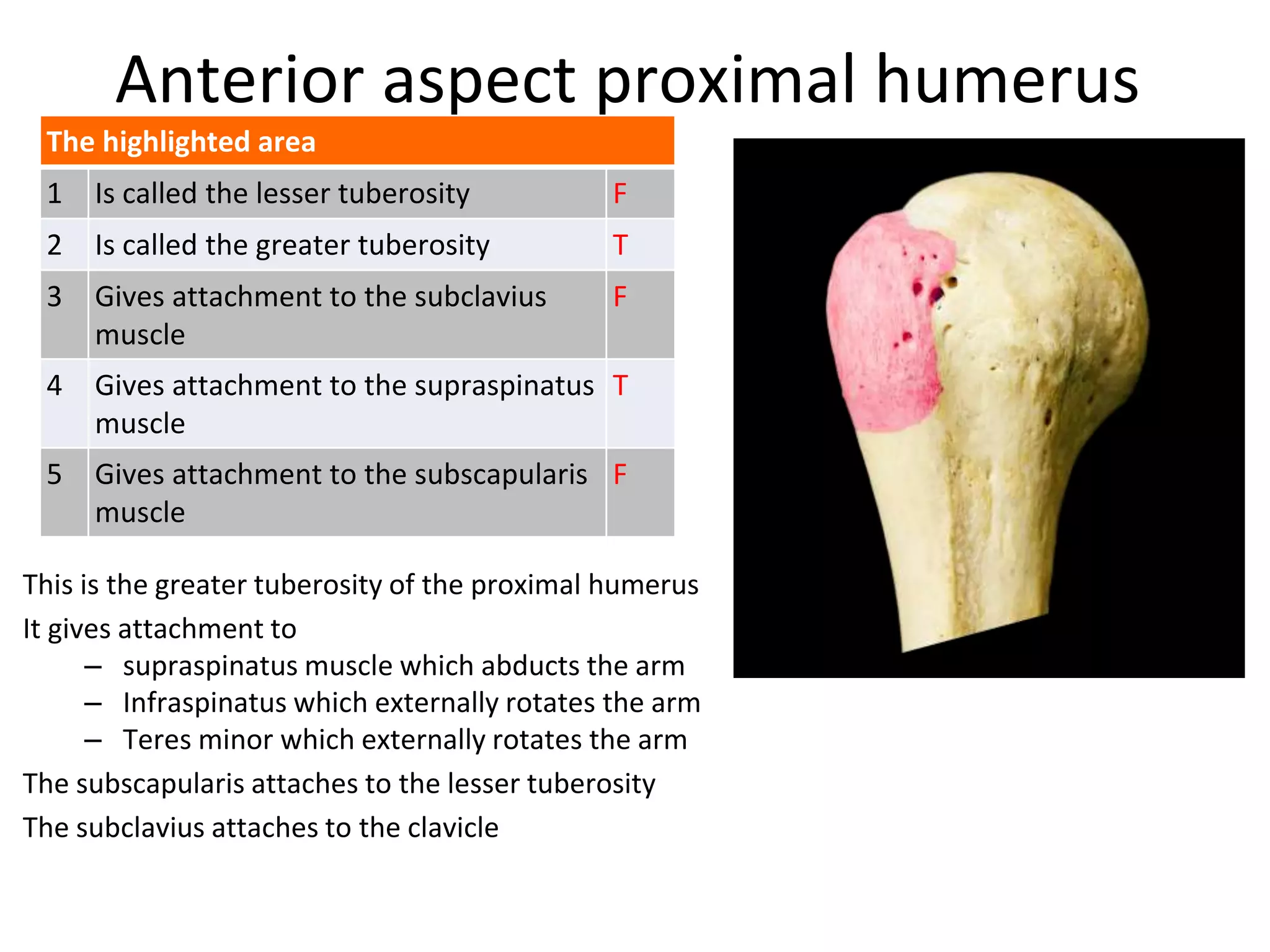 Anterior aspect proximal humerus
The highlighted area
1 Is called the lesser tuberosity F
2 Is called the greater tuberosity T
3 Gives attachment to the subclavius
muscle
F
4 Gives attachment to the supraspinatus
muscle
T
5 Gives attachment to the subscapularis
muscle
F
This is the greater tuberosity of the proximal humerus
It gives attachment to
– supraspinatus muscle which abducts the arm
– Infraspinatus which externally rotates the arm
– Teres minor which externally rotates the arm
The subscapularis attaches to the lesser tuberosity
The subclavius attaches to the clavicle
 