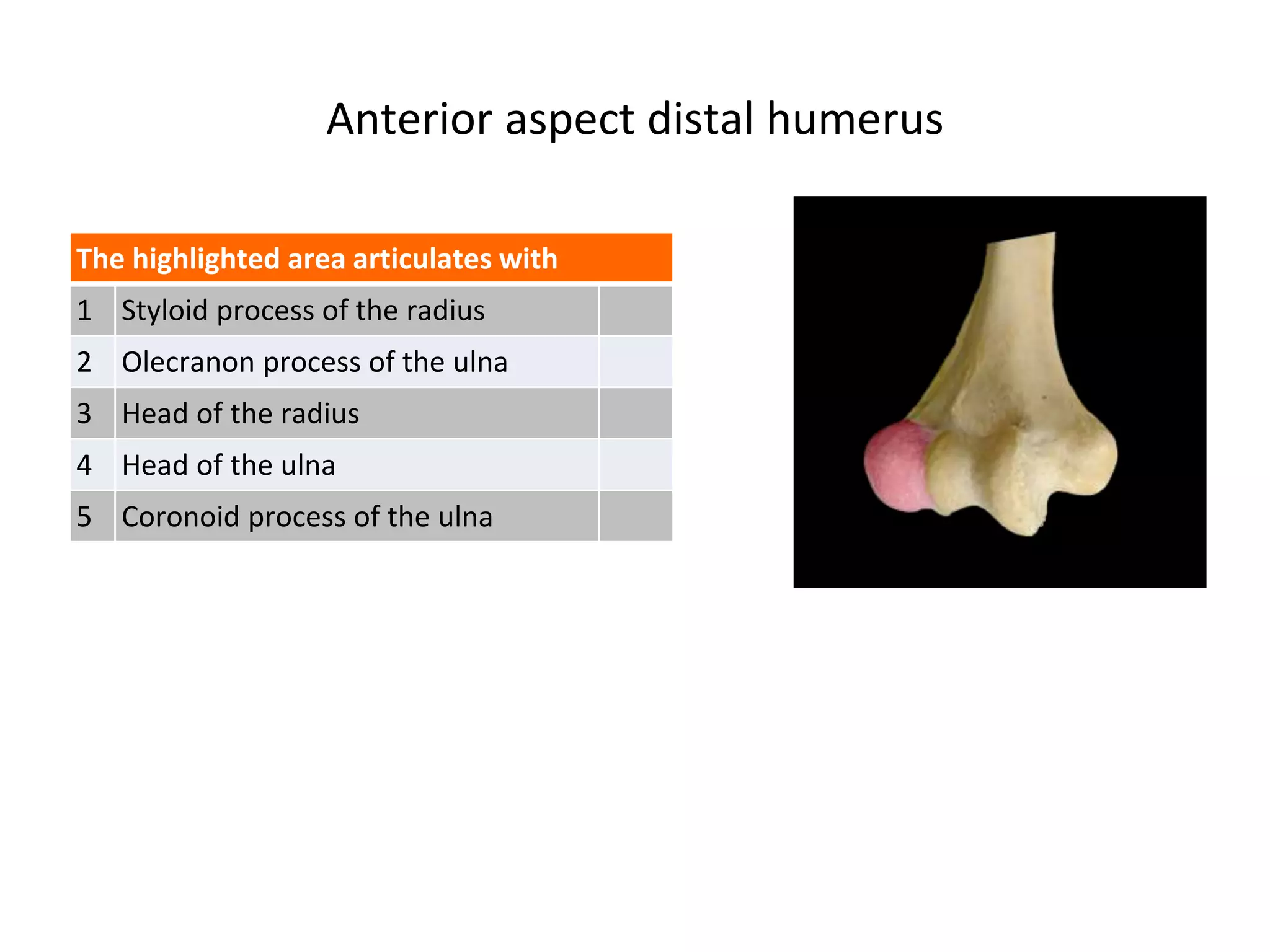 Anterior aspect distal humerus
The highlighted area articulates with
1 Styloid process of the radius
2 Olecranon process of the ulna
3 Head of the radius
4 Head of the ulna
5 Coronoid process of the ulna
 