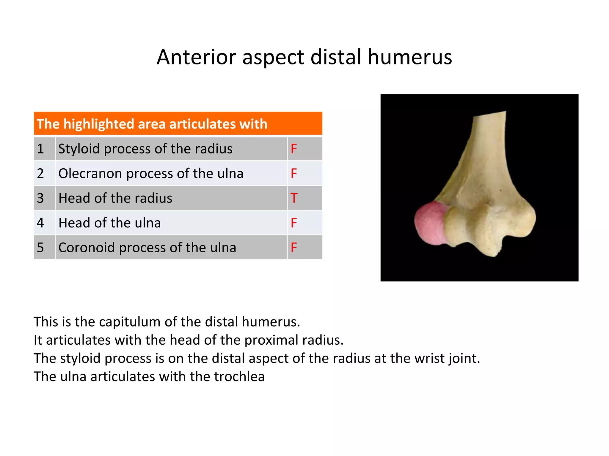 Anterior aspect distal humerus
The highlighted area articulates with
1 Styloid process of the radius F
2 Olecranon process of the ulna F
3 Head of the radius T
4 Head of the ulna F
5 Coronoid process of the ulna F
This is the capitulum of the distal humerus.
It articulates with the head of the proximal radius.
The styloid process is on the distal aspect of the radius at the wrist joint.
The ulna articulates with the trochlea
 