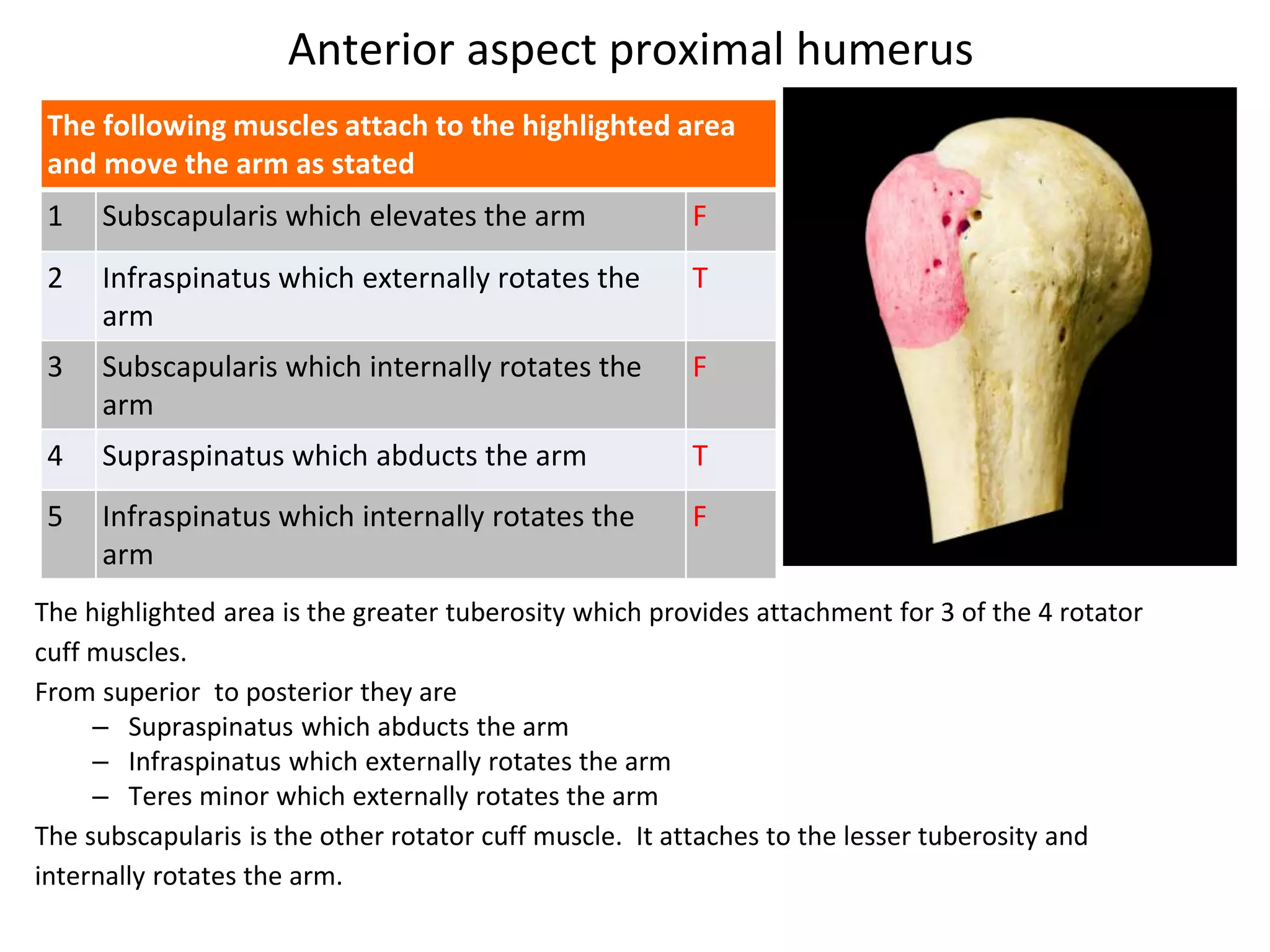 Anterior aspect proximal humerus
The following muscles attach to the highlighted area
and move the arm as stated
1 Subscapularis which elevates the arm F
2 Infraspinatus which externally rotates the
arm
T
3 Subscapularis which internally rotates the
arm
F
4 Supraspinatus which abducts the arm T
5 Infraspinatus which internally rotates the
arm
F
The highlighted area is the greater tuberosity which provides attachment for 3 of the 4 rotator
cuff muscles.
From superior to posterior they are
– Supraspinatus which abducts the arm
– Infraspinatus which externally rotates the arm
– Teres minor which externally rotates the arm
The subscapularis is the other rotator cuff muscle. It attaches to the lesser tuberosity and
internally rotates the arm.
 