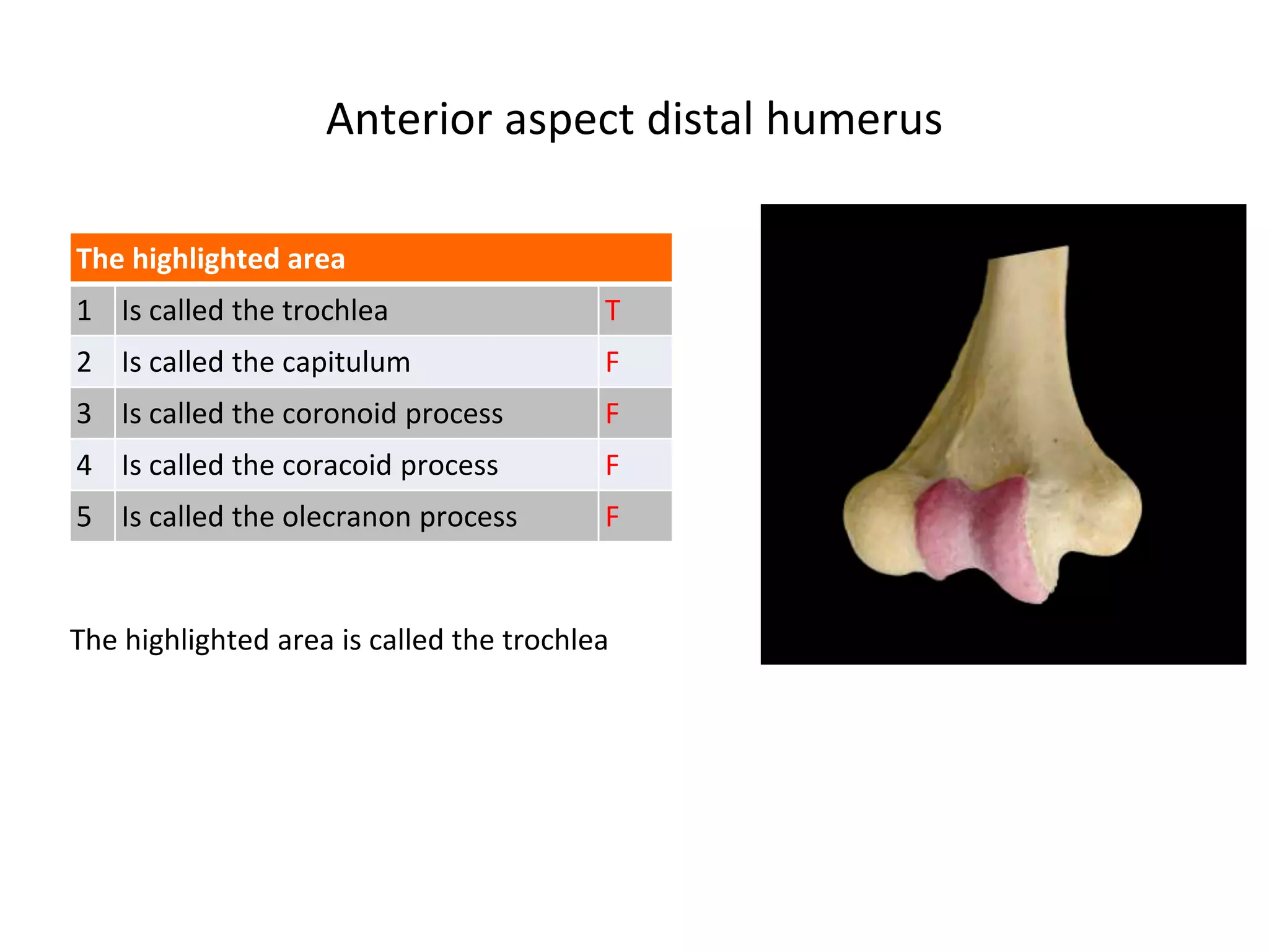 Anterior aspect distal humerus
The highlighted area is called the trochlea
The highlighted area
1 Is called the trochlea T
2 Is called the capitulum F
3 Is called the coronoid process F
4 Is called the coracoid process F
5 Is called the olecranon process F
 