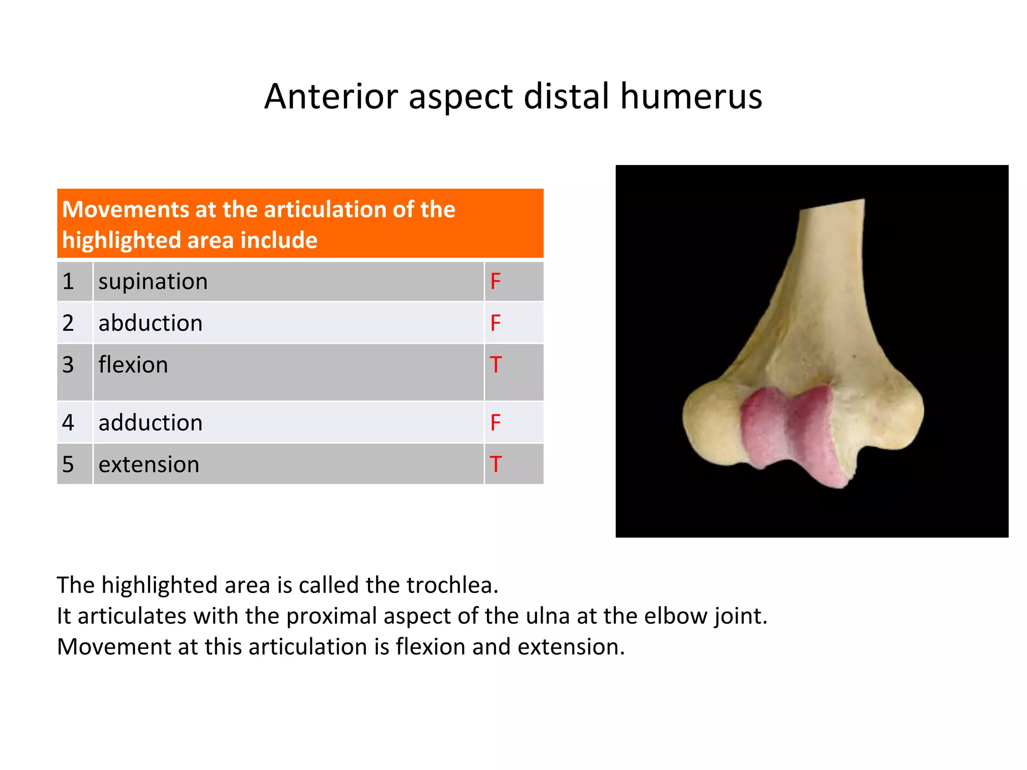 Anterior aspect distal humerus
The highlighted area is called the trochlea.
It articulates with the proximal aspect of the ulna at the elbow joint.
Movement at this articulation is flexion and extension.
Movements at the articulation of the
highlighted area include
1 supination F
2 abduction F
3 flexion T
4 adduction F
5 extension T
 
