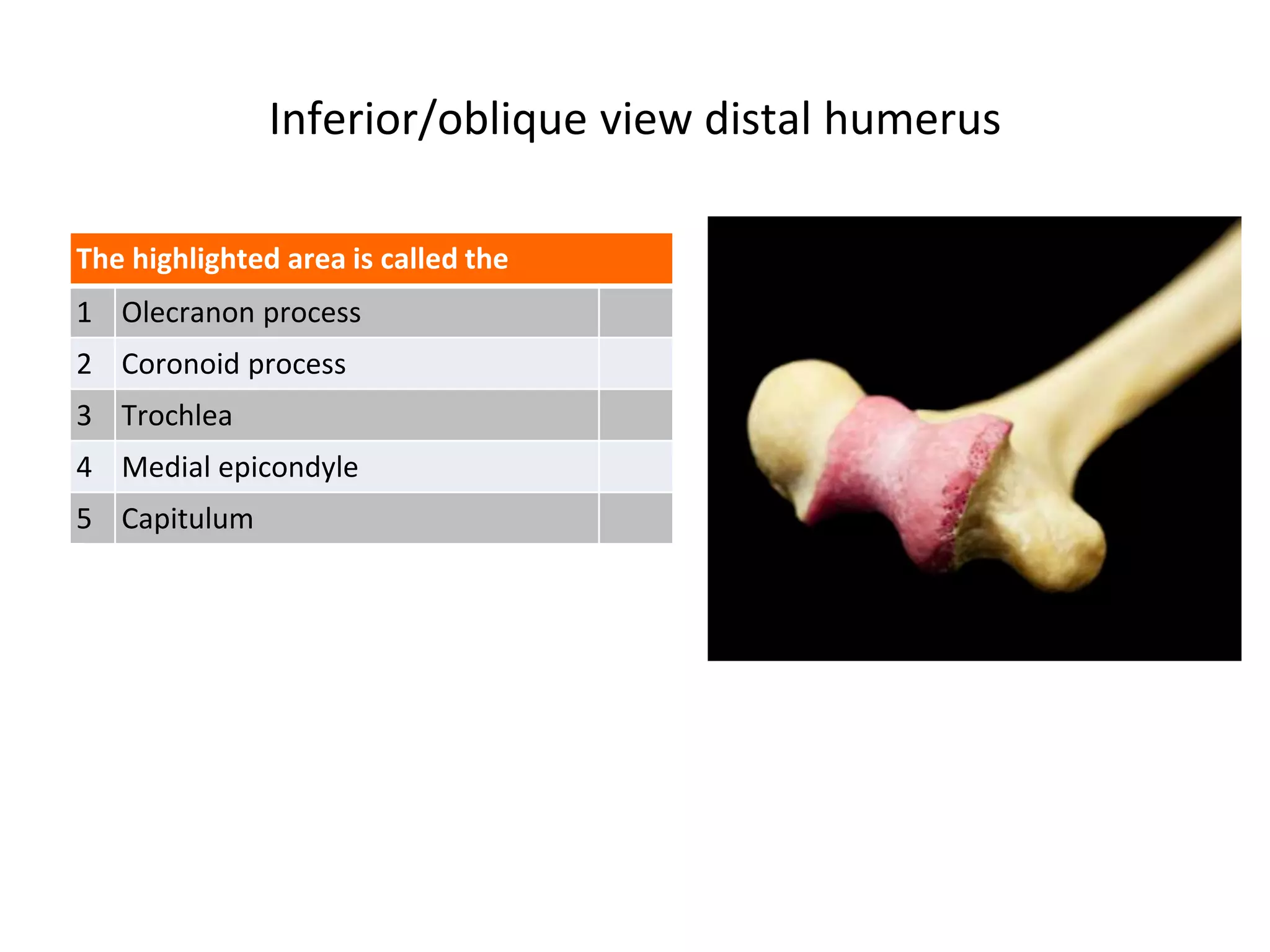 Inferior/oblique view distal humerus
The highlighted area is called the
1 Olecranon process
2 Coronoid process
3 Trochlea
4 Medial epicondyle
5 Capitulum
 