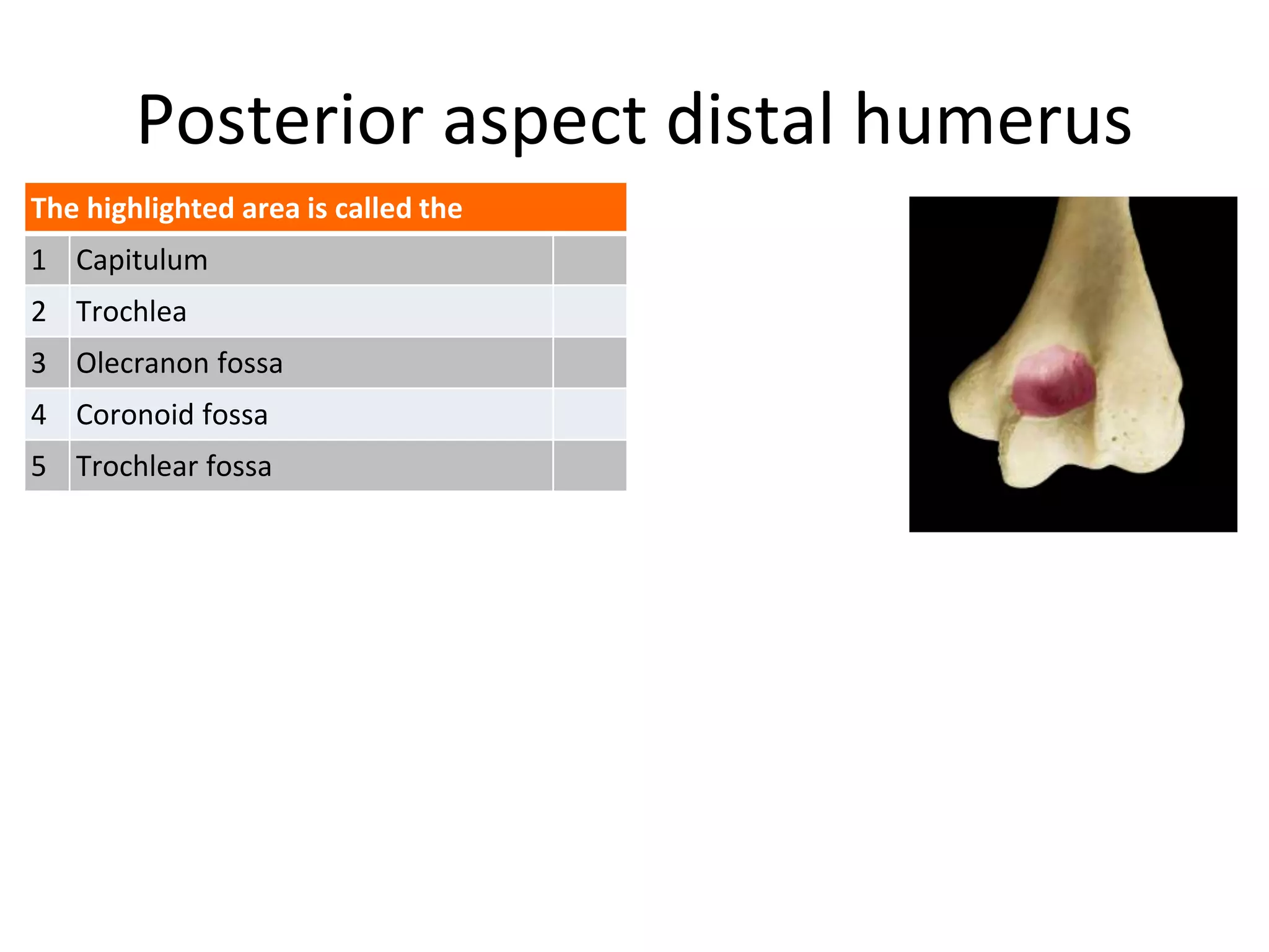 Posterior aspect distal humerus
The highlighted area is called the
1 Capitulum
2 Trochlea
3 Olecranon fossa
4 Coronoid fossa
5 Trochlear fossa
 
