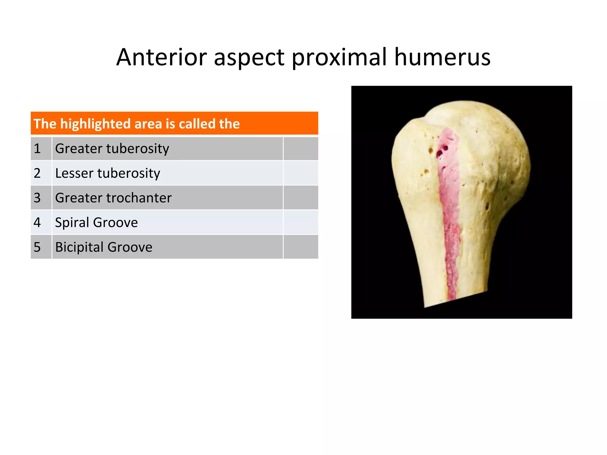 Anterior aspect proximal humerus
The highlighted area is called the
1 Greater tuberosity
2 Lesser tuberosity
3 Greater trochanter
4 Spiral Groove
5 Bicipital Groove
 