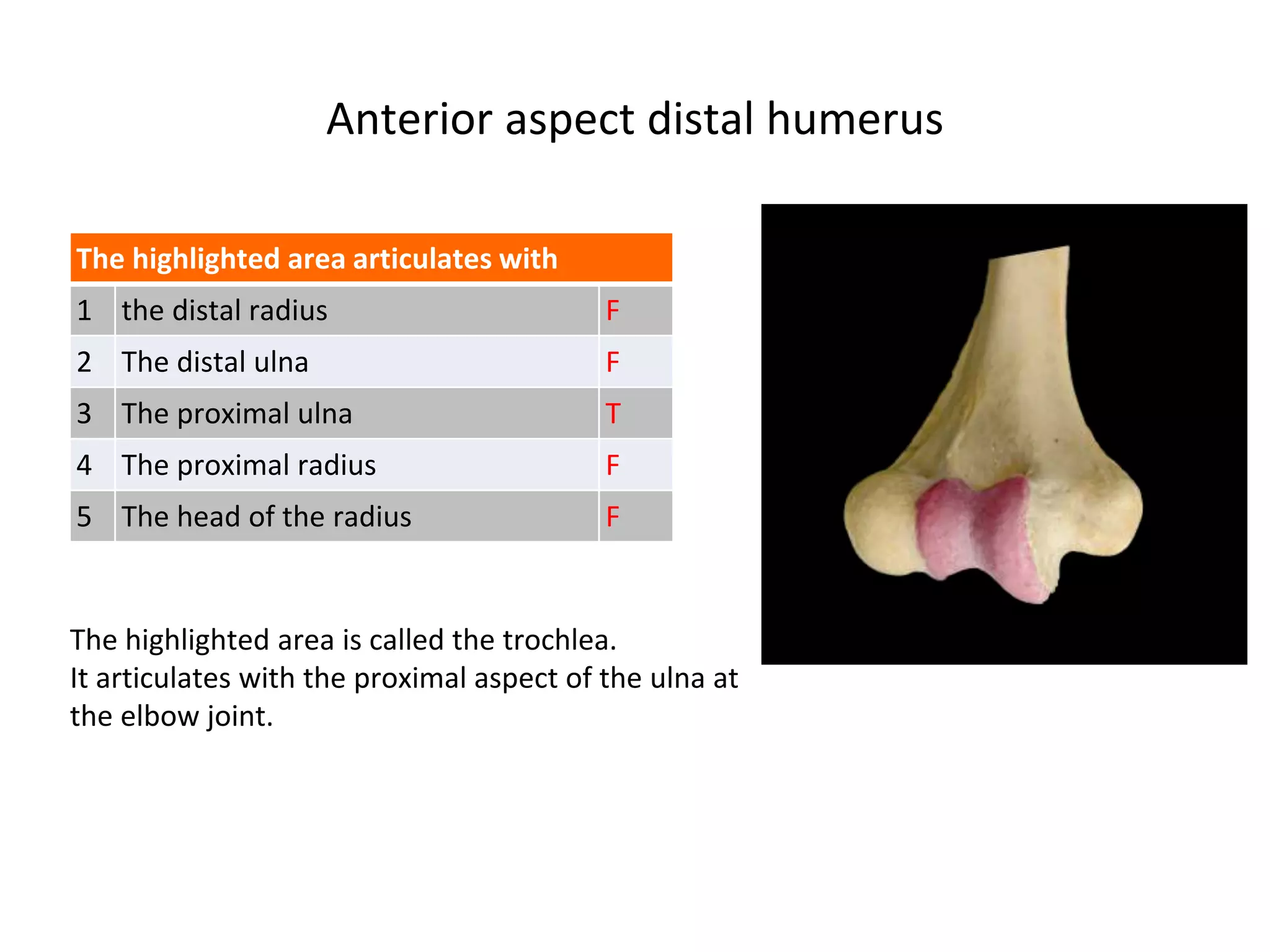 Anterior aspect distal humerus
The highlighted area is called the trochlea.
It articulates with the proximal aspect of the ulna at
the elbow joint.
The highlighted area articulates with
1 the distal radius F
2 The distal ulna F
3 The proximal ulna T
4 The proximal radius F
5 The head of the radius F
 