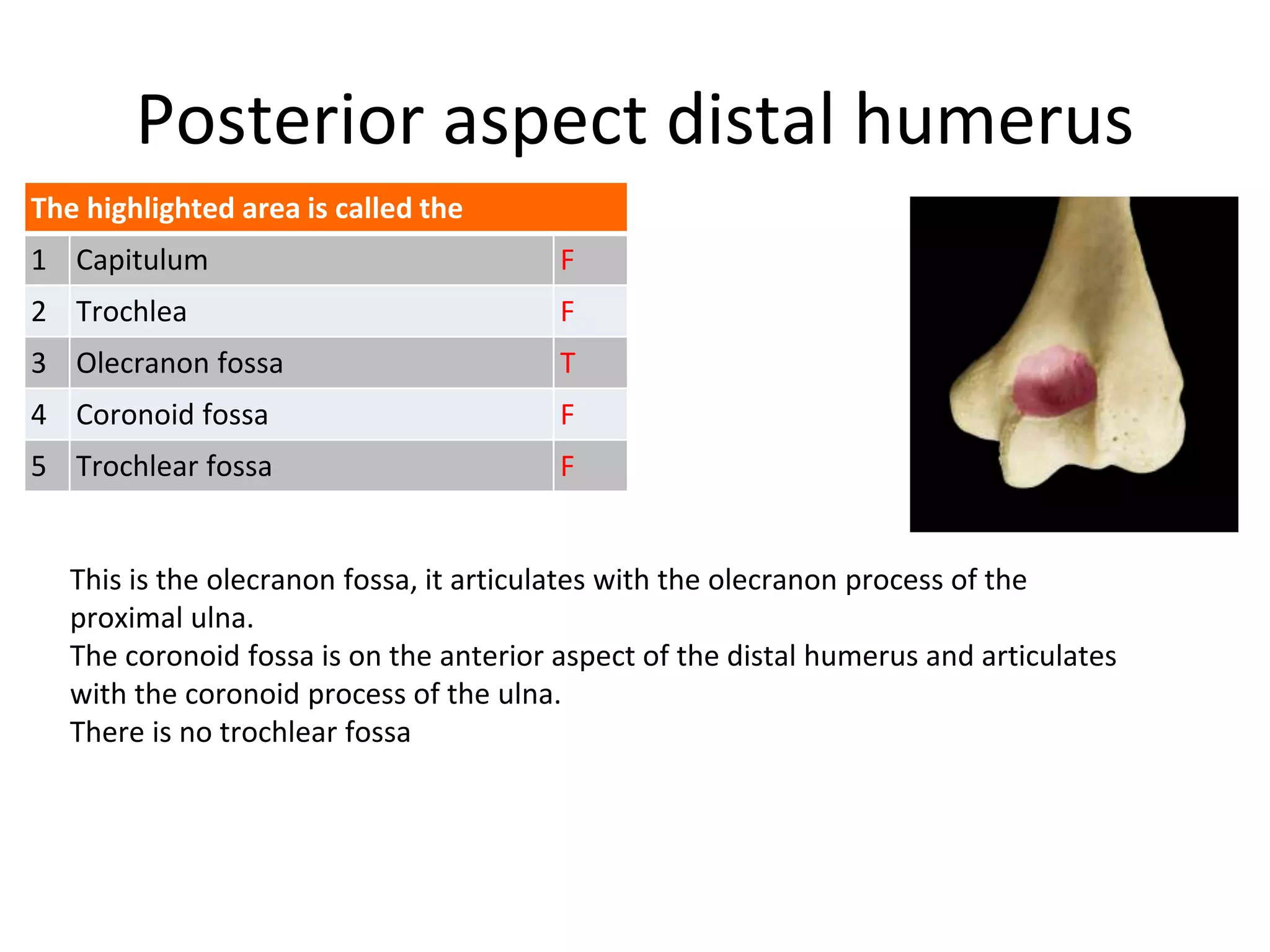Posterior aspect distal humerus
This is the olecranon fossa, it articulates with the olecranon process of the
proximal ulna.
The coronoid fossa is on the anterior aspect of the distal humerus and articulates
with the coronoid process of the ulna.
There is no trochlear fossa
The highlighted area is called the
1 Capitulum F
2 Trochlea F
3 Olecranon fossa T
4 Coronoid fossa F
5 Trochlear fossa F
 