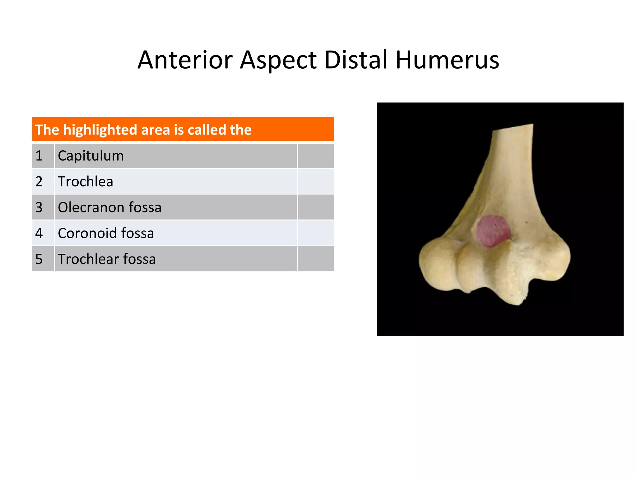 Anterior Aspect Distal Humerus
The highlighted area is called the
1 Capitulum
2 Trochlea
3 Olecranon fossa
4 Coronoid fossa
5 Trochlear fossa
 